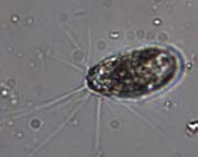 Chlamydophrys sp.