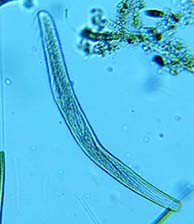 Spitostomum teres