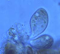 Tetrahymena sp. feeding on Tardigrade